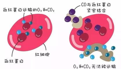 警惕洗澡季隱形殺手 一氧化碳中毒康復后，當心遲發性腦病